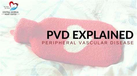 Peripheral Vascular Disease (PVD) Explained – Central Georgia Heart Center