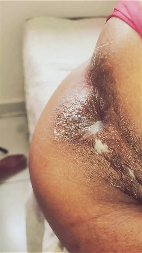 Small Crown Has Her Ass Wide Open By Eater Amateur Porn Feat Anal Queen Amateur XHamster