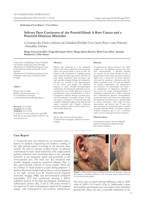 Pdf Salivary Duct Carcinoma Of The Parotid Gland A Rare Cancer And A