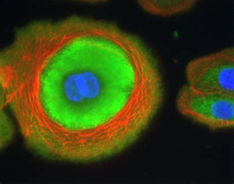 Nhek In Vitro Model In Cosmetics Testing Bioalternatives