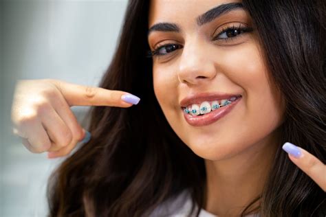 orthodontics face mask 5