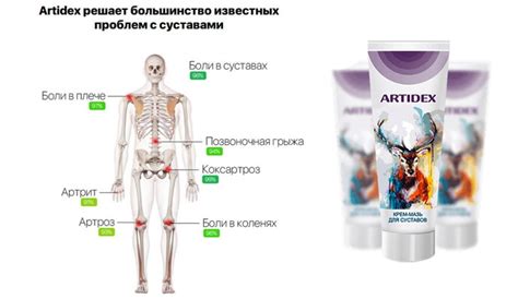Артидекс мазь для суставов - отзывы, цена крема, купить, развод или нет