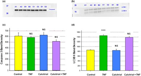 Calcitriol Modifies Tight Junctions Improves Barrier Function And