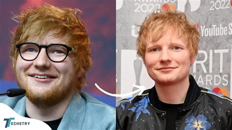 Ed Sheeran Plastic Surgery Astonishing Shape Of You” Fame Before