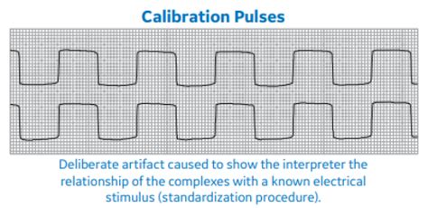 Arrhythmia Recognition Part 2 Clinical View