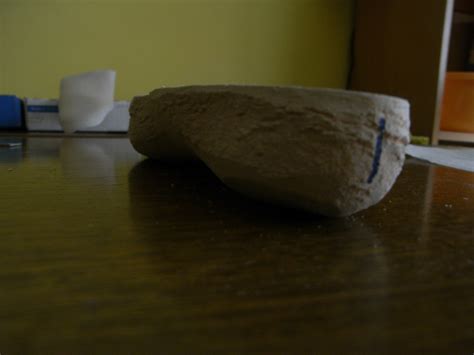Ortopodologia Y Biomecanica Medial Y Lateral Heel Skive