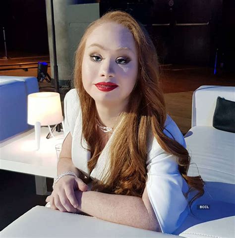 Meet Madeline Stuart Worlds 1st Supermodel With Down Syndrome The