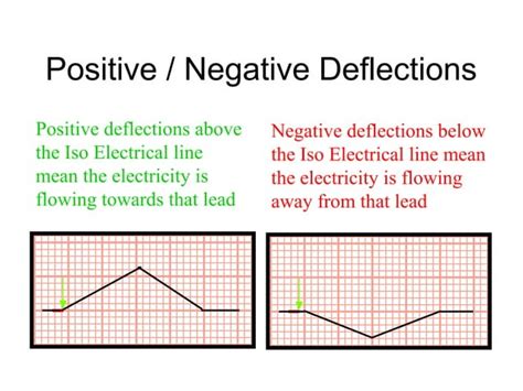 ECG leads | PPT