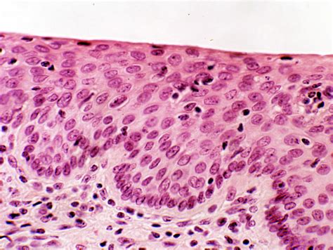 Types Of Epithelial Tissue Under A Microscope