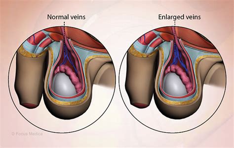 Health Condition Symptoms Causes Treatment And More