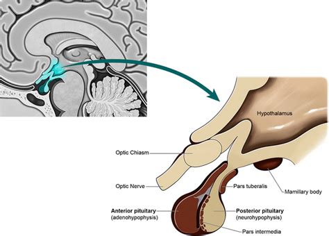 Hypophyseal Fossa Of Sphenoid Bone