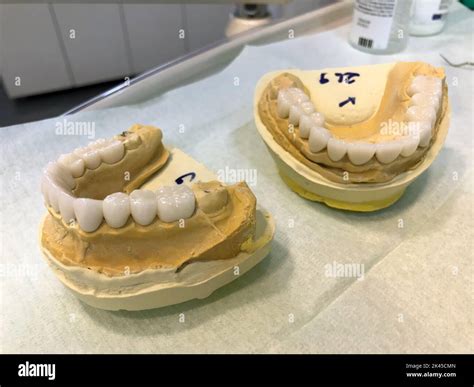 Zirconia Dental Crowns Orthodontic Prosthetics Stock Photo Alamy