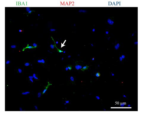 Video Sex Differences In Mouse Hippocampal Astrocytes After In Vitro Ischemia