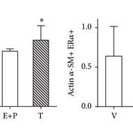 Regulation of ERα protein content by sex hormones in airway smooth Download Scientific Diagram