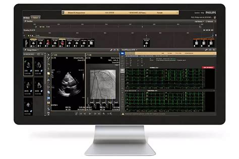Cardiovascular Workspace Multi Modality Cardiology Image And
