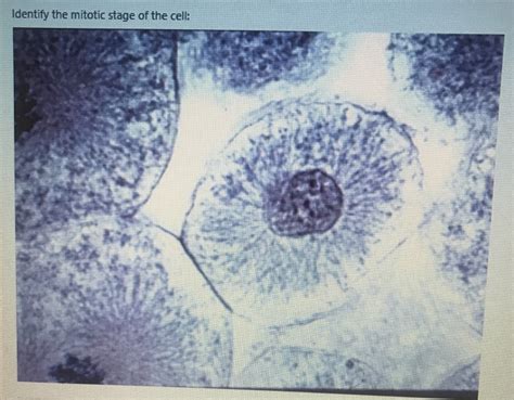 Solved Identify The Mitotic Stage Of The Cell Chegg