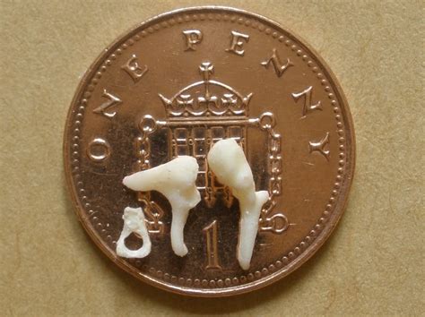 Bone 2, set of ossicles.