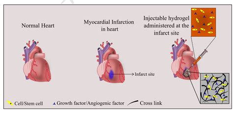 Figure 3 From Hydrogel Based Injectable Scaffolds For Cardiac Tissue Regeneration Semantic