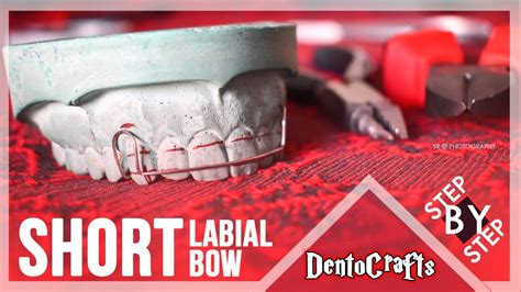 [diy Easily] Short Labial Bow Preclinical Orthodontics Dentistry Youtube