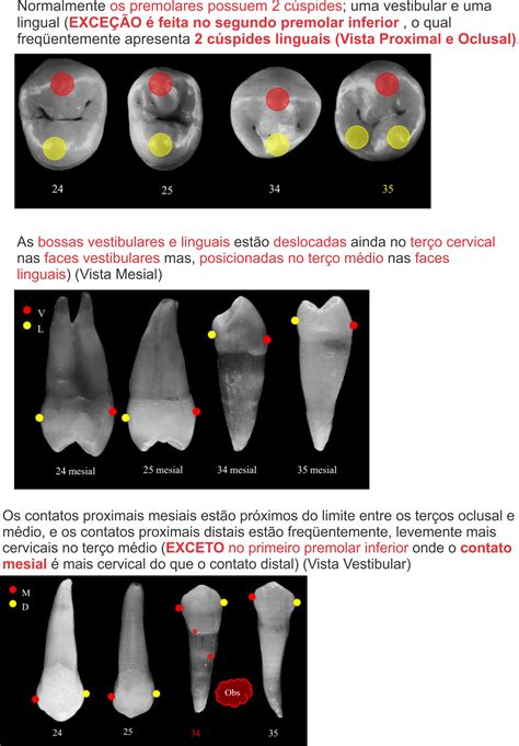 Anatomia 2 Pré Molar Superior BRAINCP