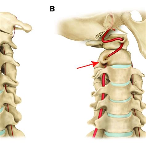 Magnetic resonance and dynamic angiography findings in patients with... | Download Scientific