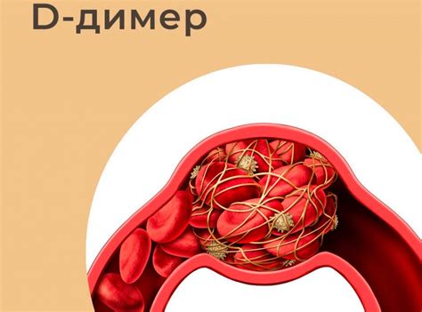 Тест на Д-димер