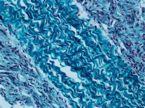 Tecido Conjuntivo Denso Modelado Atlas De Histologia Veterinária