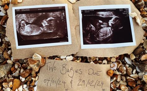 Lesbian Couple On Carrying Each Others Babies Through Ivf