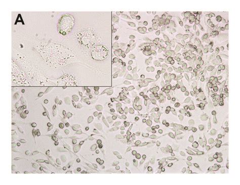 Trypan Blue Stained Cells With Compromised Membrane Are Blue