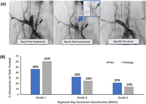 Preclinical Safety And Efficacy Evaluation Of The Pipeline Vantage