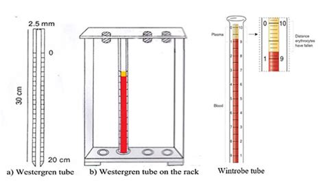 erythrocyte sedimentation rate esr