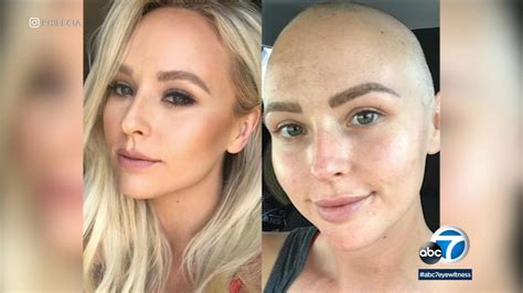 Breast Cancer Survivor Raises Awareness On Tiktok Following Her