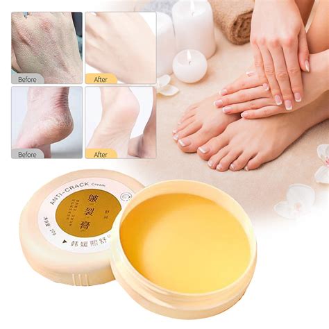 Advanced Repair Hand & Foot Cream for Dry, Cracked Skin - Moisturizing