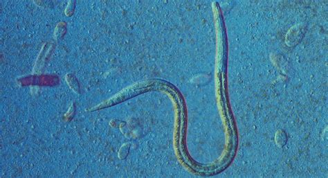 Threadworms In Children Ages One To Five Babycentre