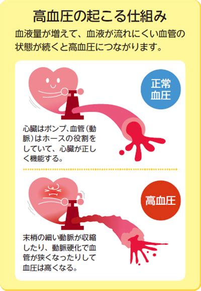 これからの寒い季節は要注意！高血圧 健康食品のインシップ