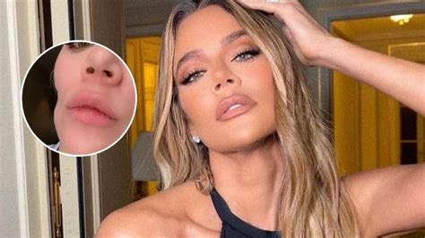 La impactante transformación de Khloé Kardashian tras quitarse un tumor