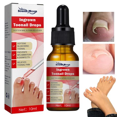 Products For Ingrown Toenails at Tawana Tibbs blog