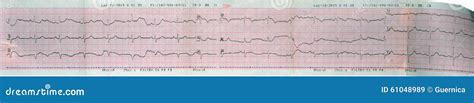 Echocardiogram Ecg Ekg Heart Reading Stock Image Image Of