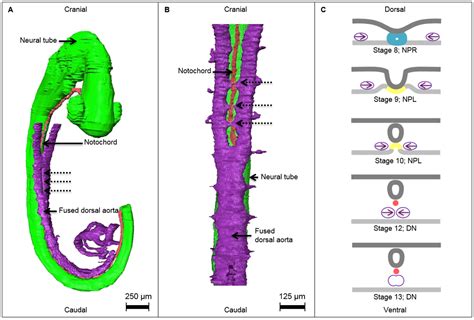 Human Notochord