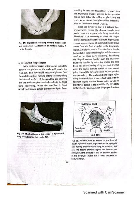 Prosthodontic Treatment For Edentulous Patients 13th Edition 1