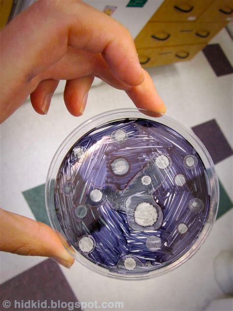 Craftimism: Petri Dish Art