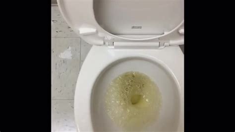 Me Pissing At My Doctors Free Porn Videos YouPornGay