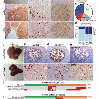 Upregulation Of AKT And NICD Targets YAP1 And SOX9 In Hepatocytes In