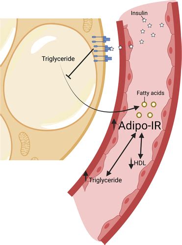 Adipose Insulin Resistance Associates With Dyslipidemia Independent Of