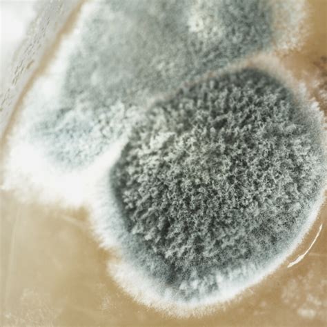 Can A Person Get Mold In Their Body at Joe Ken blog