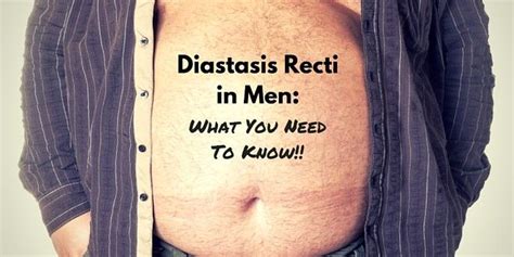Diastasis Recti In Men And Women What You Need To Know Diastasis