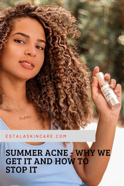 Summer Acne Why We Get It And How To Stop It Summer Acne Skin Care