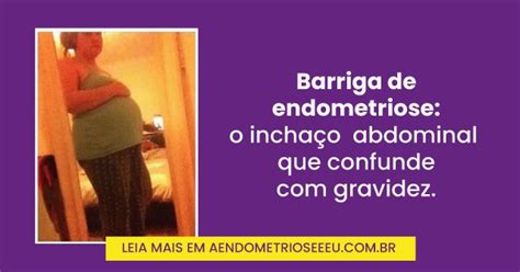Endometriose Deixa A Barriga Inchada - Últimos posts | Endometriose