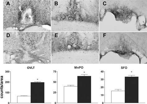 Salt Depletion Induces Enhanced C Fos Immunostaining Of The