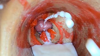 Camera Inside Deep Pussy Captures Big Dose Ejaculation Of Sperm Asmr Xvideos